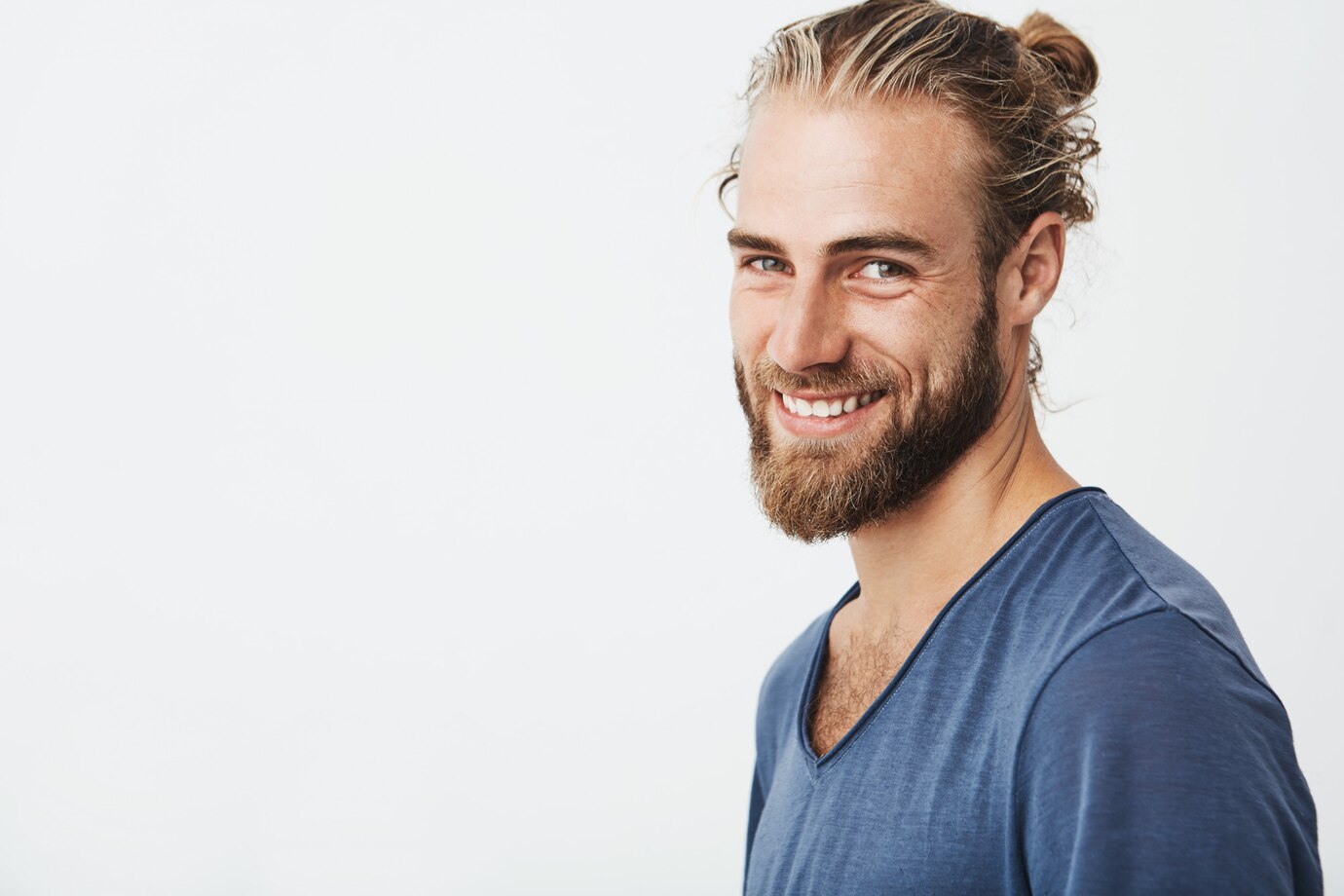 Hombre con barba sonriendo después de un injerto de barba en Madrid